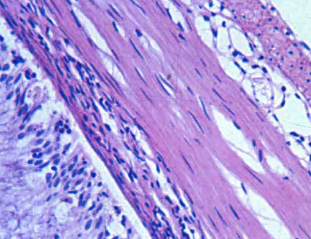 The transverse of intestinal tract